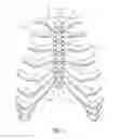 Fig. 02 - System for longitudinal closure of dissected sternums