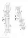 Fig. 08 - Bone plating system and method