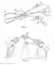 Fig. 05 - Enhanced control systems including flexible shielding and support systems for electrosurgical applications