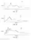 Fig. 06 - Enhanced control systems including flexible shielding and support systems for electrosurgical applications