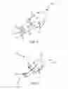 Fig. 03 - Ablation catheter designs and methods with enhanced diagnostic capabilities