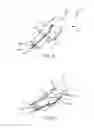 Fig. 04 - Ablation catheter designs and methods with enhanced diagnostic capabilities