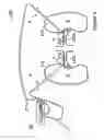 Fig. 10 - Methods for bilateral renal neuromodulation