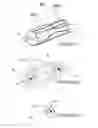 Fig. 03 - Methods for therapeutic renal neuromodulation