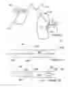 Fig. 04 - Methods for therapeutic renal neuromodulation