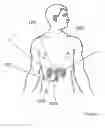 Fig. 11 - Methods for therapeutic renal neuromodulation