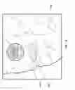 Fig. 20 - Microwave energy-delivery device and system