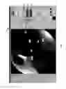 Fig. 07 - Visualization guided ACL localization system