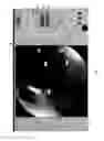 Fig. 08 - Visualization guided ACL localization system