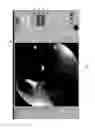 Fig. 10 - Visualization guided ACL localization system