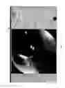 Fig. 16 - Visualization guided ACL localization system