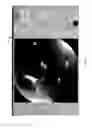 Fig. 17 - Visualization guided ACL localization system