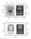 Fig. 04 - Systems and methods for planning hair transplantation