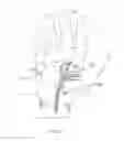 Fig. 04 - Therapeutic skin lifting device and related systems and methods
