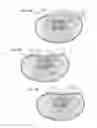 Fig. 05 - Therapeutic skin lifting device and related systems and methods