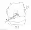 Fig. 13 - Methods, systems, and devices for gauging a bone tunnel