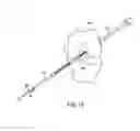 Fig. 14 - Methods, systems, and devices for gauging a bone tunnel