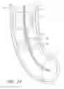 Fig. 20 - Body-inserted tube cleaning
