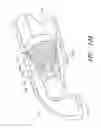Fig. 32 - Body-inserted tube cleaning
