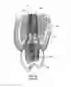 Fig. 03 - Restoration dental implant system and method
