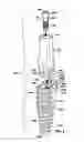 Fig. 12 - Restoration dental implant system and method