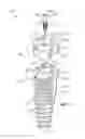 Fig. 15 - Restoration dental implant system and method