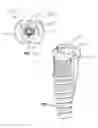 Fig. 17 - Restoration dental implant system and method