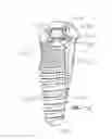Fig. 19 - Restoration dental implant system and method