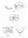 Fig. 05 - Method and system for the construction of a dental prosthesis