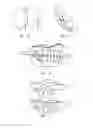 Fig. 06 - Method and system for the construction of a dental prosthesis