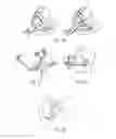 Fig. 09 - Method and system for the construction of a dental prosthesis
