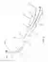 Fig. 04 - Insertion device and method for delivery of a mesh carrier