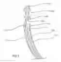 Fig. 09 - Insertion device and method for delivery of a mesh carrier