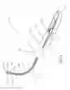 Fig. 10 - Insertion device and method for delivery of a mesh carrier
