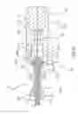 Fig. 14 - Insertion device and method for delivery of a mesh carrier