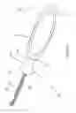 Fig. 15 - Insertion device and method for delivery of a mesh carrier