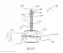 Fig. 16 - Insertion device and method for delivery of a mesh carrier