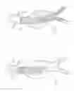 Fig. 03 - Devices, systems, and methods for prosthesis delivery and implantation, including the use of a fastener tool