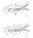 Fig. 41 - Devices, systems, and methods for prosthesis delivery and implantation, including the use of a fastener tool