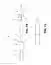 Fig. 04 - Aortic embolic protection device
