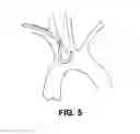 Fig. 10 - Aortic embolic protection device