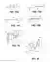 Fig. 20 - Aortic embolic protection device