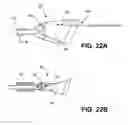 Fig. 25 - Aortic embolic protection device