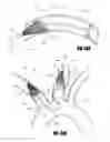 Fig. 41 - Aortic embolic protection device