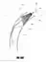 Fig. 42 - Aortic embolic protection device