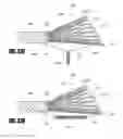 Fig. 47 - Aortic embolic protection device