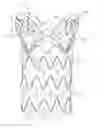 Fig. 01 - ASCENDING AORTA STENT-GRAFT SYSTEM