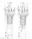 Fig. 12 - ASCENDING AORTA STENT-GRAFT SYSTEM