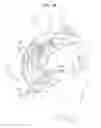 Fig. 22 - ASCENDING AORTA STENT-GRAFT SYSTEM