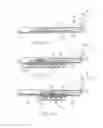 Fig. 04 - Device for rapid repair of body conduits
